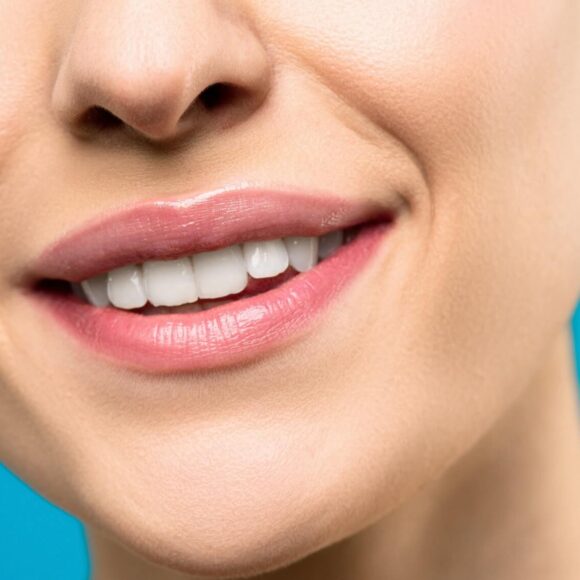 Guide To Professional Teeth Whitening