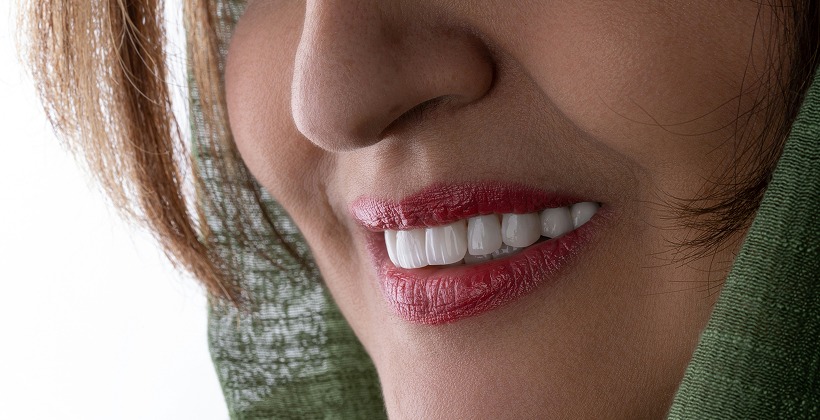 How Long Does Teeth Whitening Last? Tips to Maintain Results How Long Does Teeth Whitening Last? Tips to Maintain Results